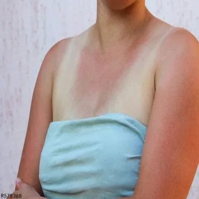 晒黑的皮肤怎么变白