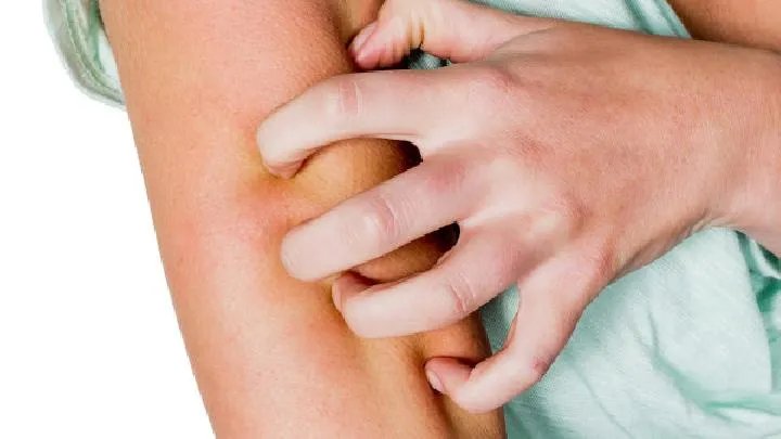 重症肌无力的症状有哪些呢