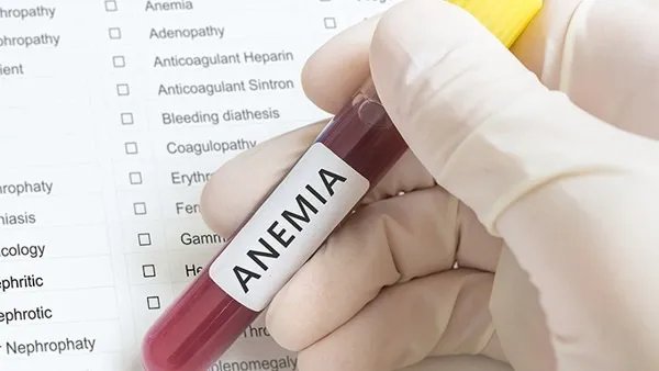 血小板减少怎么办