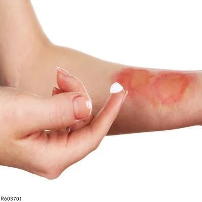 去烫伤疤痕的方法有哪些