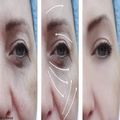 绿原酸的功效与作用 绿原酸的作用有哪些