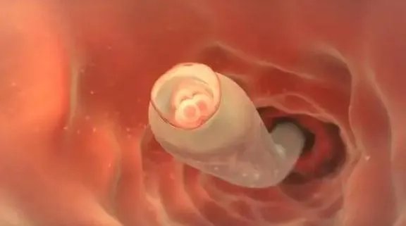 北京试管助孕-北京海淀区妇幼保健院生殖科试管婴儿怎么做？