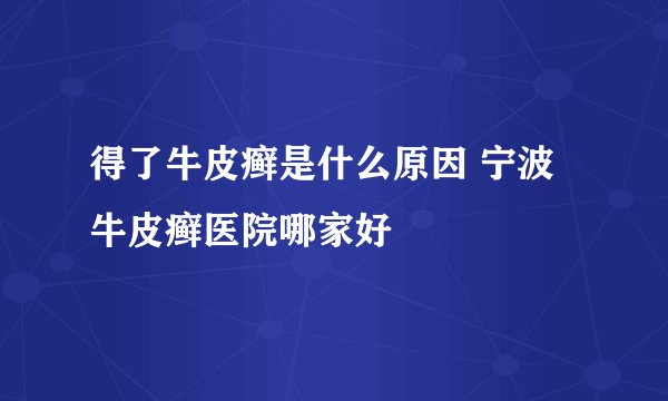 得了牛皮癣是什么原因 宁波牛皮癣医院哪家好