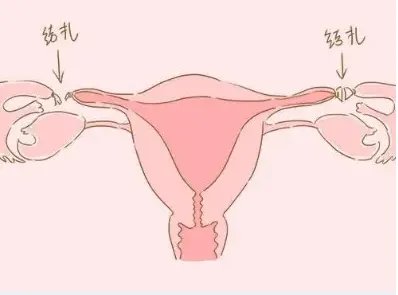 三代试管哪个医院好-成都市妇女儿童中心医院和华西附属第二医院，哪个做试管比较好？