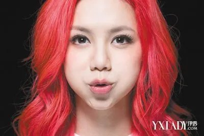 邓紫棋金鱼嘴的原因