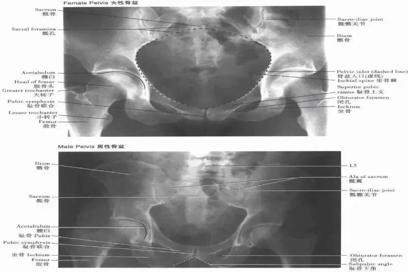 正常的骨盆正位X片图解