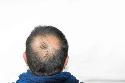 淋巴瘤晚期死前征兆是什么