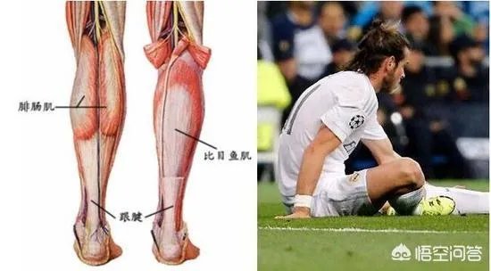 贝尔比目鱼肌为什么老受伤