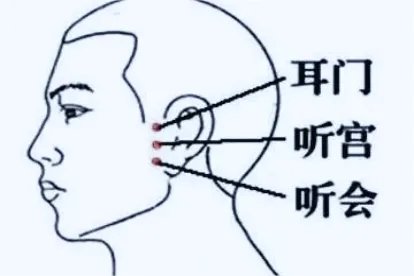 听会在耳朵的哪个位置图