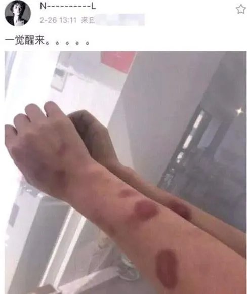 黄景瑜回应家暴：有没有家暴是什么情况揭开（图）