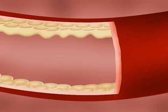 血热的症状有哪些
