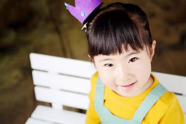 小孩流鼻血怎么办