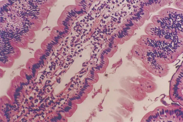 小肠绒毛结构示意图