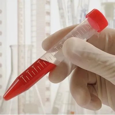 最好的牛皮癣医院怎么治疗 