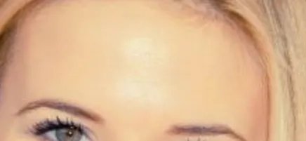 发际线调整需要多少钱