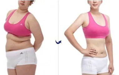 抽脂要多少钱全身