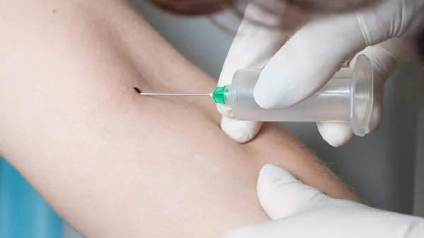 输血的不良反应有哪些