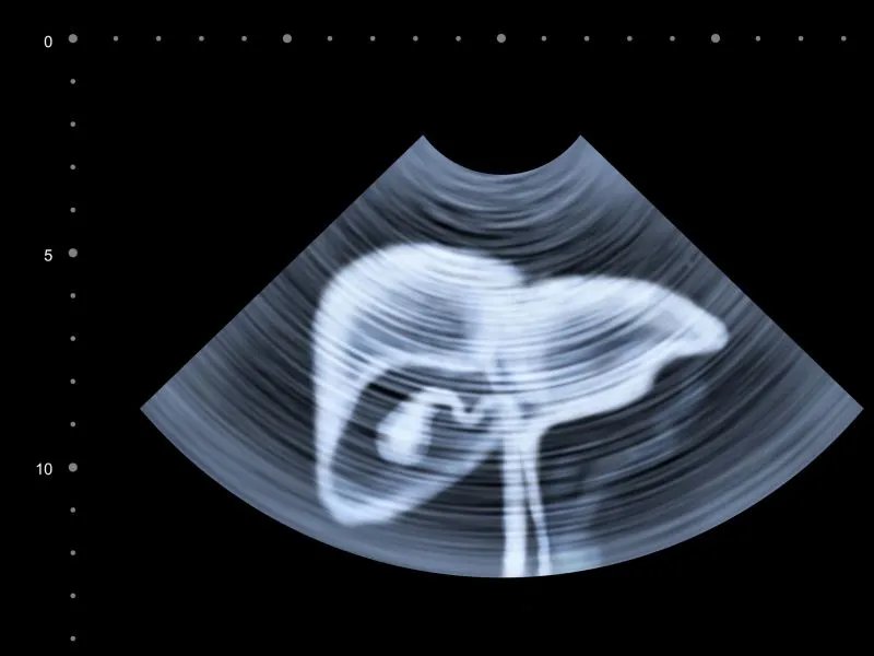 常见的防辐射食品