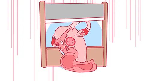 磁共振能检查什么