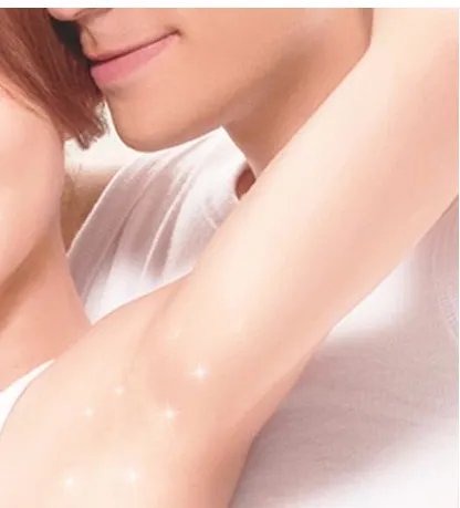 冰点脱毛有副作用吗