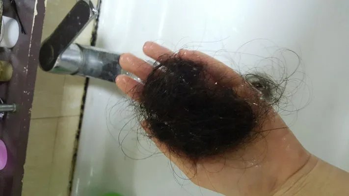 防脱发洗发水哪个好？