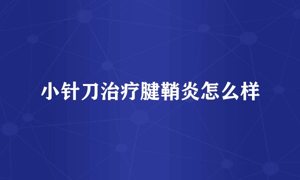 小针刀治疗腱鞘炎怎么样