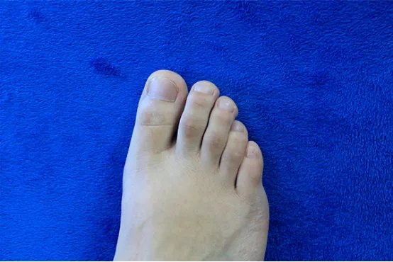 脚趾甲空了怎么回事