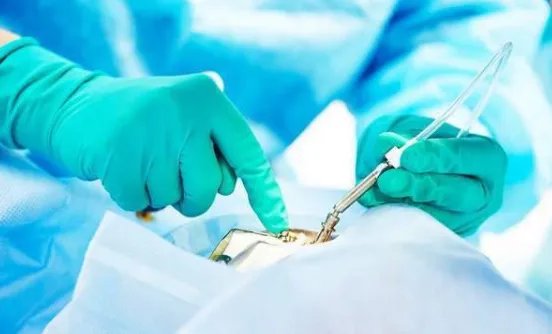 艾芬回应爱尔眼科核查报告，几乎失明到底是谁的错？