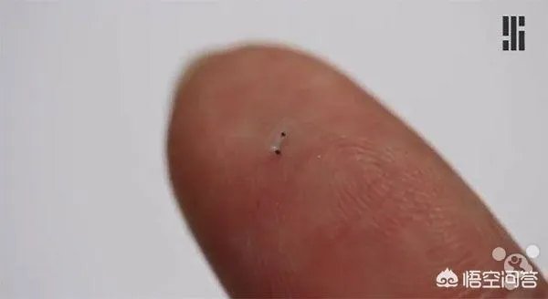 在未来，能做全身的血管支架手术吗？