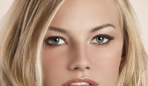 重庆美莱整形美容医院玻尿酸丰太阳穴怎么样?价格一般多少钱