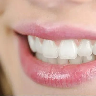 牙齿美容哪最好