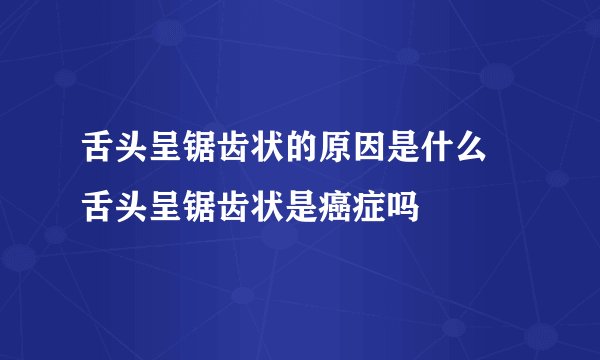 舌头呈锯齿状的原因是什么 舌头呈锯齿状是癌症吗