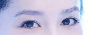 眼部吸脂的优势