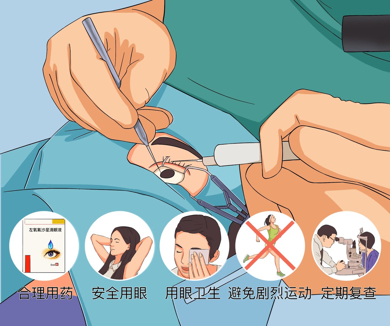 做完近视眼手术需要注意什么