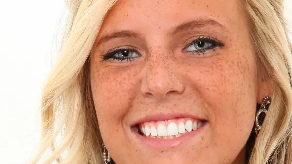 激光祛斑危害有哪些