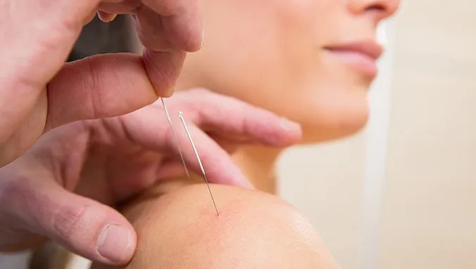 牛皮癣怎么治比较好