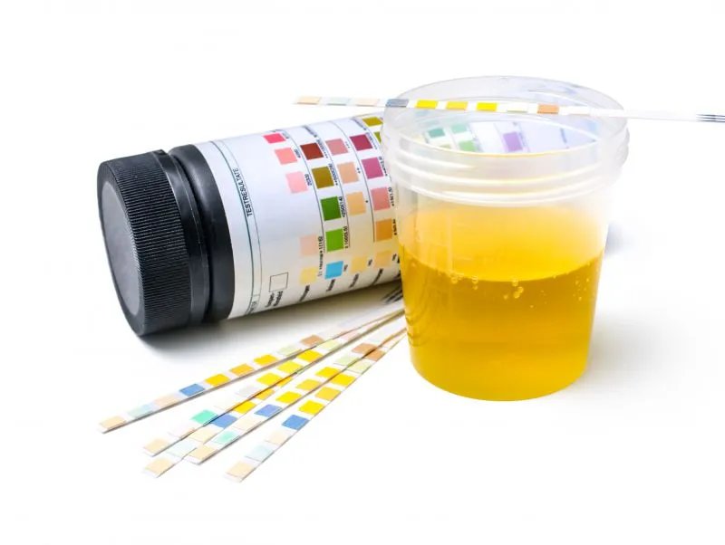 测孕试纸怎么用