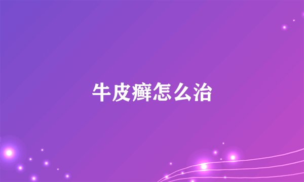牛皮癣怎么治