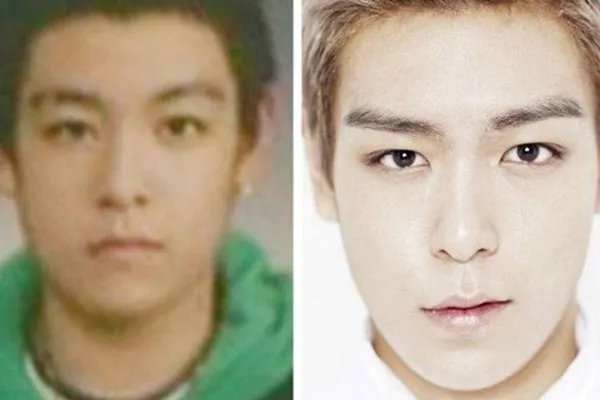 崔胜贤整容前照片曝光 bigbang成员整容前后差别大