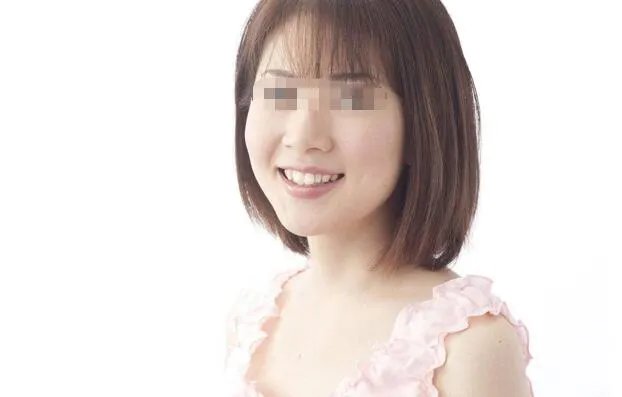 自体脂肪填充法令纹管多久