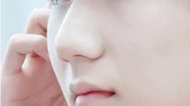 昆明鼻部微整形医院哪家好