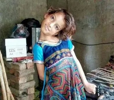 8岁女孩头部无法竖立是怎么回事？