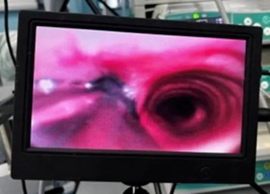 厉害了！广医五院麻醉科医生竟有“第三只眼”，引领“舒适化诊疗”新体验！