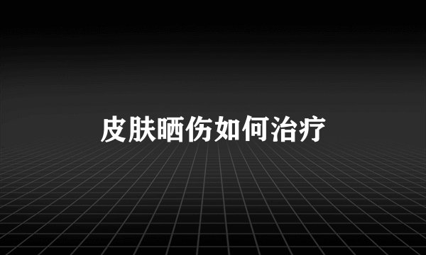 皮肤晒伤如何治疗