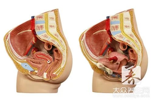 龟头冠状沟珍珠疹图片