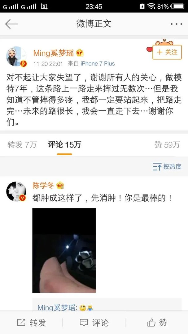 2017维秘秀奚梦瑶摔倒，你怎么看？