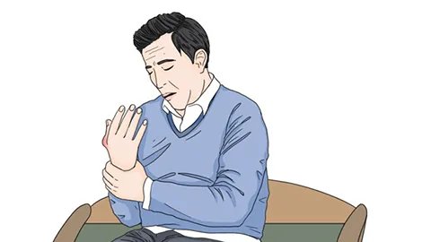 痛风症状的早期表现