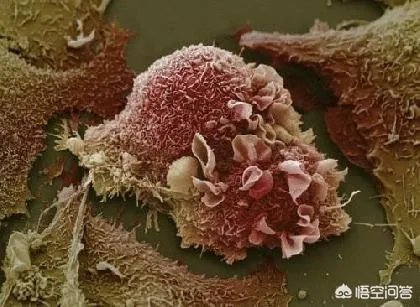 动作演员计春华因肺癌去世，对此你怎么看？