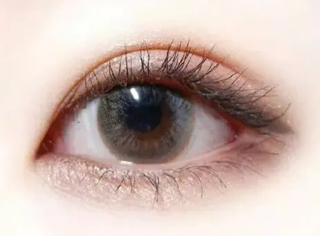 什么方法可以去鱼尾纹