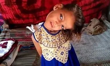 8岁女孩头部无法竖立是怎么回事？